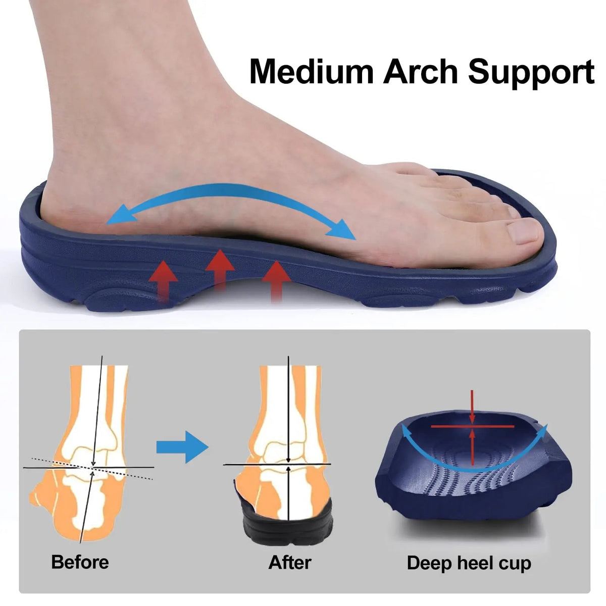 SaneShoppe - Comwarm Arch Support Sandals For Men Classic Clogs Slippers Adjustable Garden Clogs Breathable Cozy Home Shoes Men Clogs Sandals